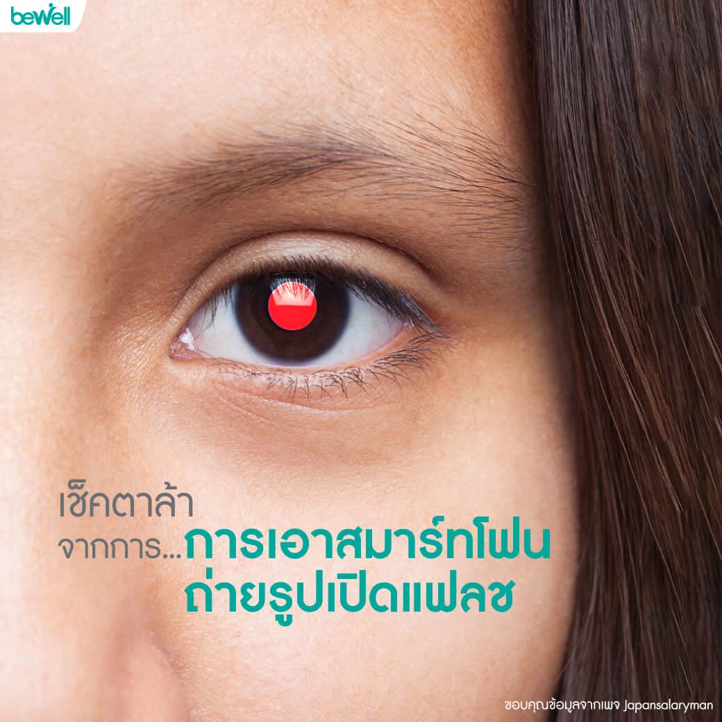 ตาล้า Bewell