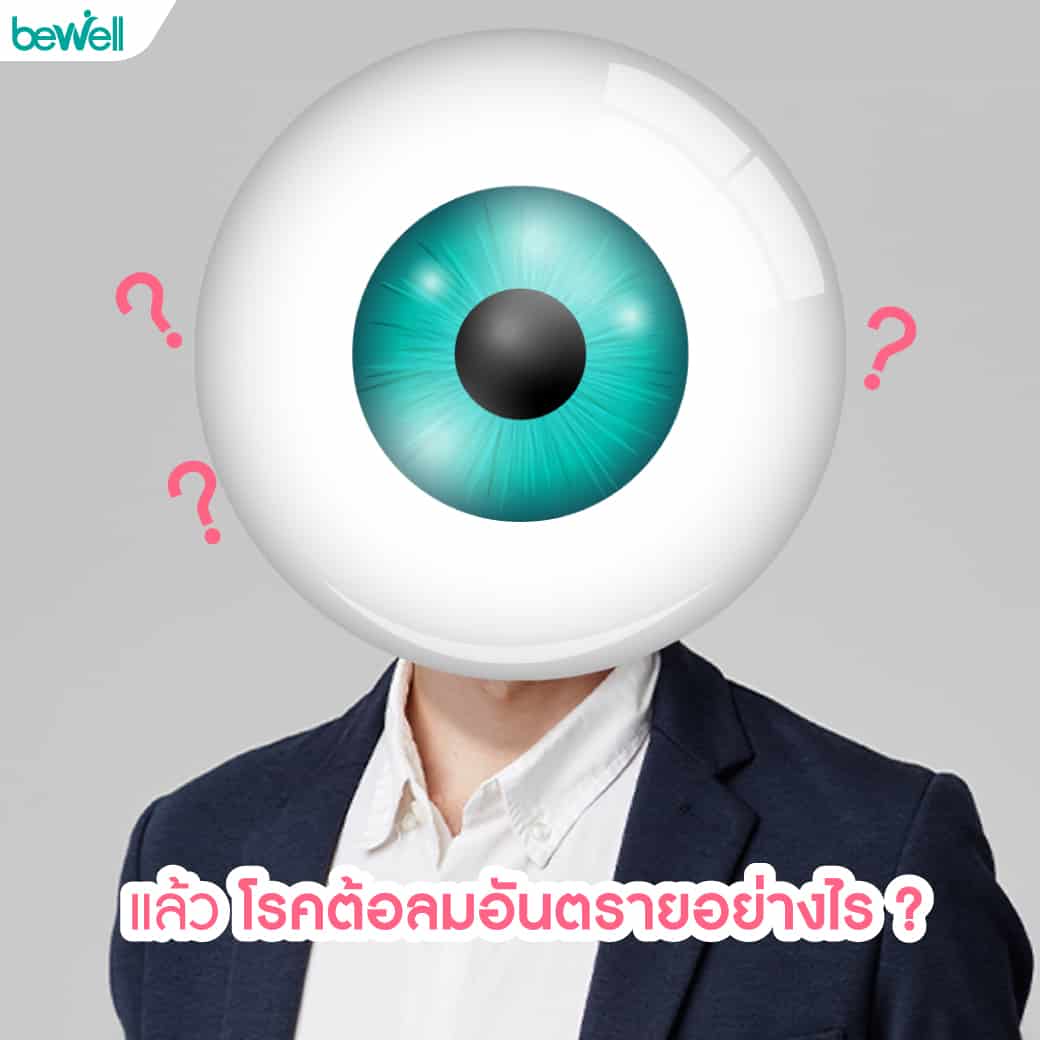 ต้อลม Bewell