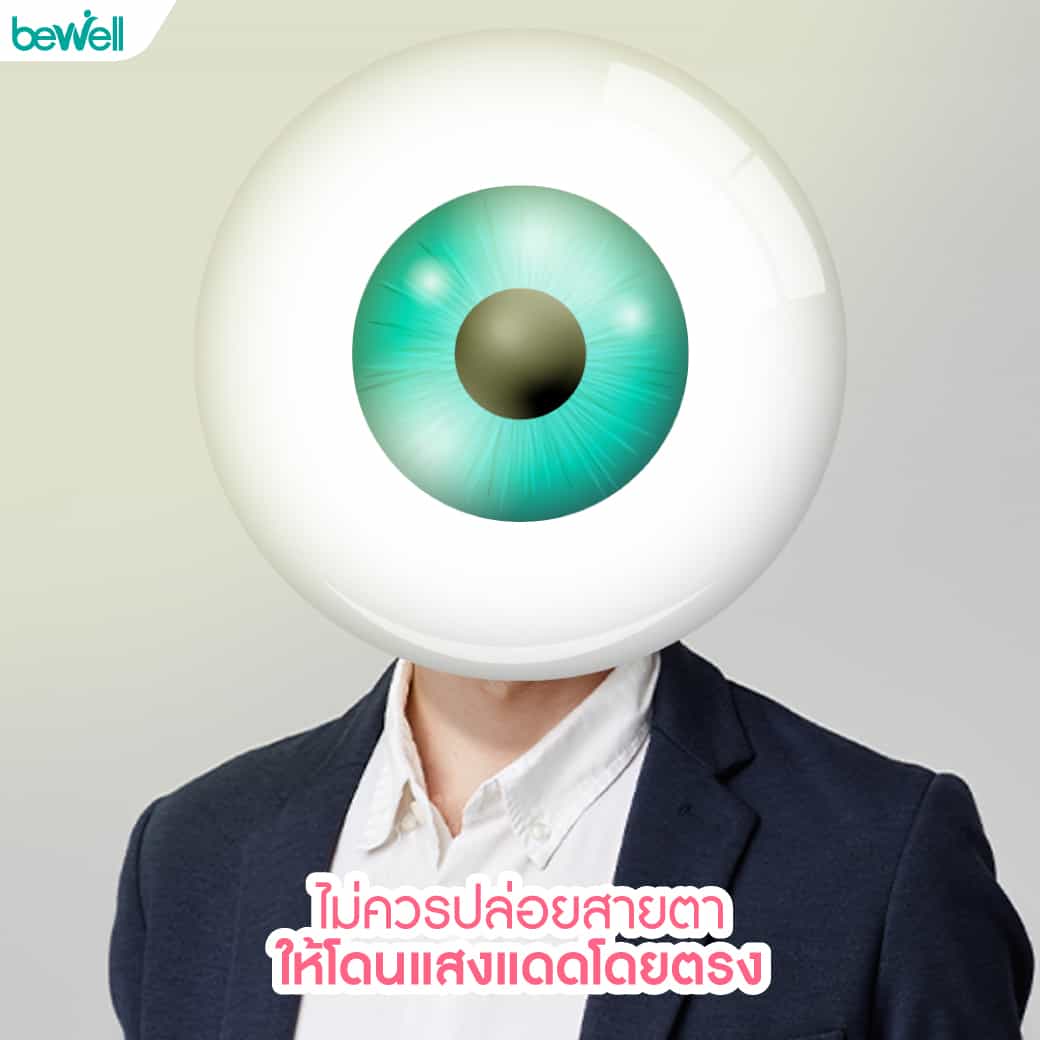 ต้อลม Bewell