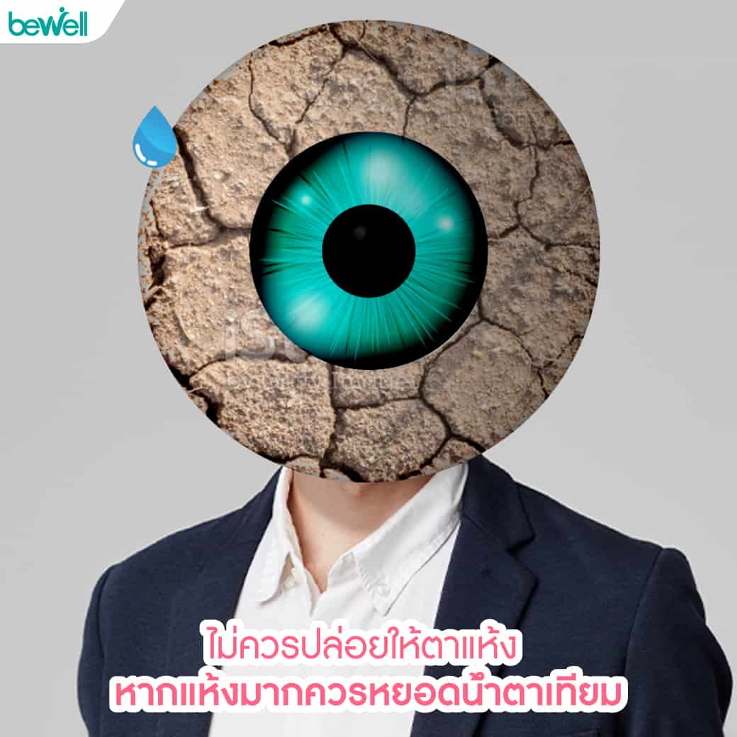 ต้อลม Bewell