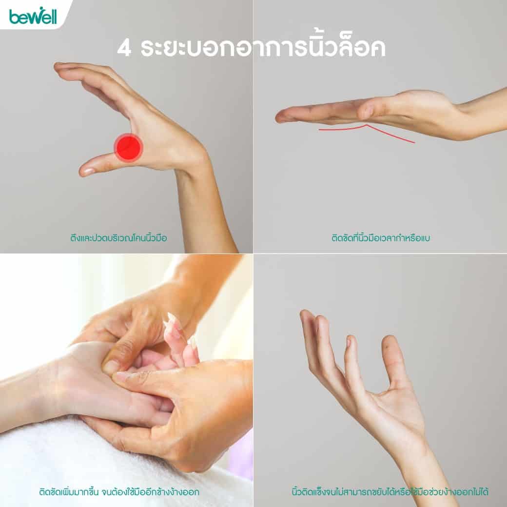 นิ้วล็อค เกิดจาก Bewell