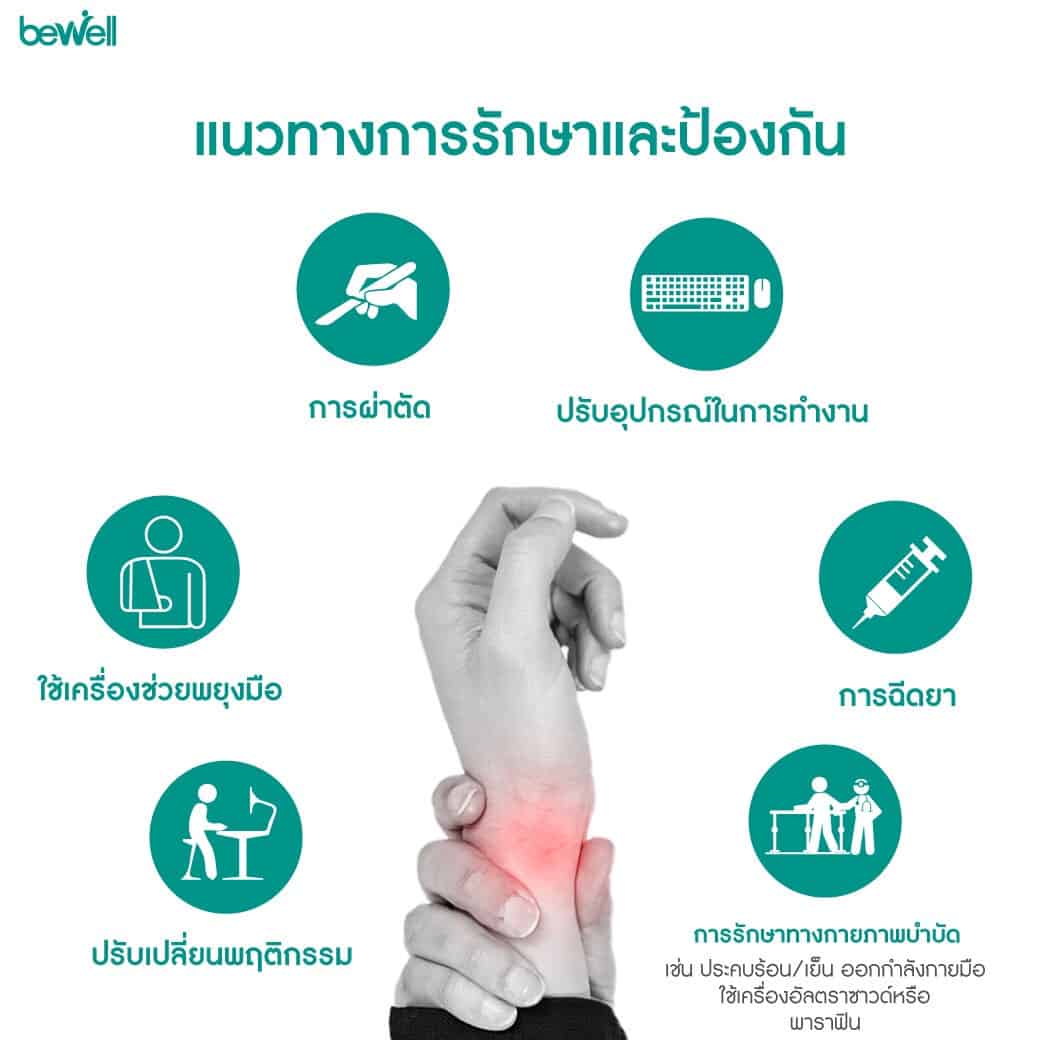 มือชา นิ้วชา Bewell