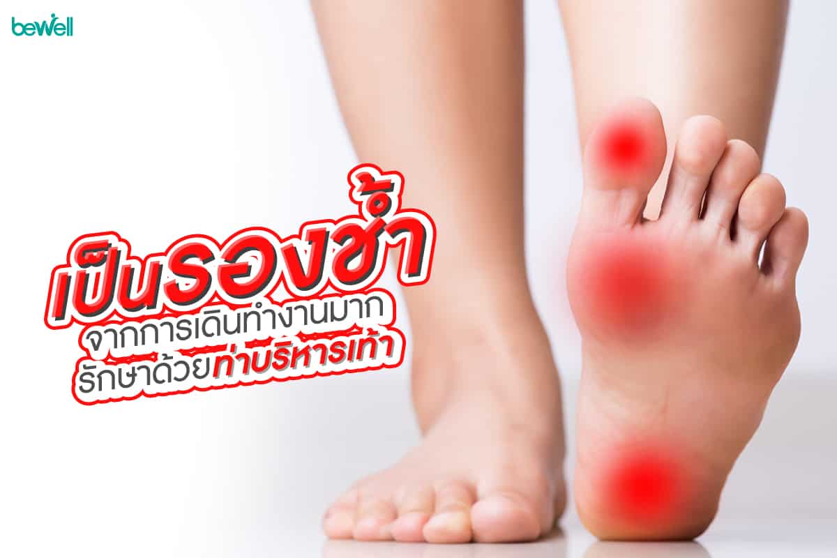 เป็นรองช้ำ จากการเดินทำงานมาก รักษาด้วยท่าบริหารเท้า - Bewell เป็นรองช้ำ จากการเดินทำงานมาก รักษาด้วยท่าบริหารเท้า - Bewell